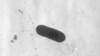 Third person in US dies in listeria outbreak tied to Boar's Head deli meats 