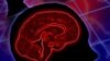 A new study finds that where patients receive treatment for a stroke can impact survival rates.