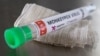 Tabung reaksi berlabel "Monkeypox virus positive" terlihat dalam ilustrasi ini yang diambil 22 Mei 2022. (Foto: REUTERS/Dado Ruvic)