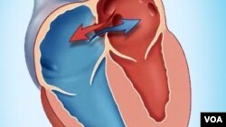 Hole In Heart