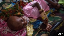 FILE - A Papuan child suffering from malnutrition lies in a hospital bed for treatment in Agats, the capital of Asmat district in Indonesia's easternmost Papua province, Jan. 26, 2018.