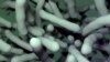 Multiple antibiotic-resistant strains of Clostridium difficile have recently emerged. Researchers have found a non-antibiotic drug that could help combat C. difficile infection. (Credit: V. Altounian/Science Translational Medicine)