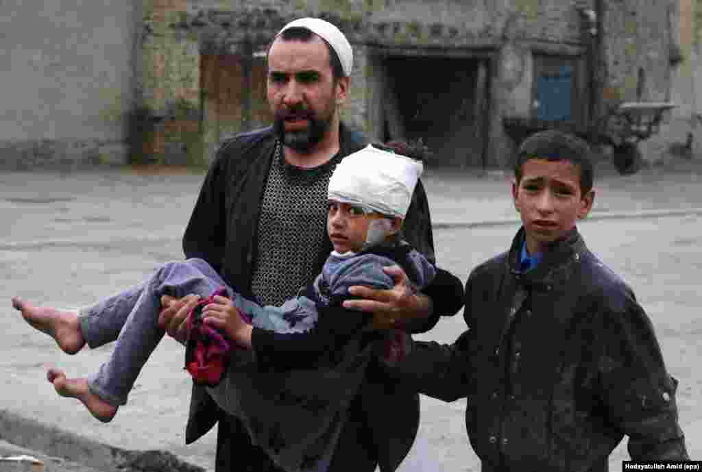 An Afghan man carries a girl who was injured in a suicide bomb blast in Kabul. A huge explosion rocked Kabul as Taliban militants attacked the Afghan Ministry of Defense, killing at least 30 people.