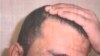 A detainee shows his scalp in an undated photo from Iraq's Abu Ghraib prison, among 198 images released in a Freedom of Information Act lawsuit against the U.S. Department of Defense in Washington, D.C., Feb. 5, 2016.