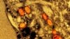 FILE - Colorized transmission electron micrograph of mpox virus particles captured at the NIAID Integrated Research Facility in Fort Detrick. Thailand has detected an mpox case in a European man who arrived from Africa last week.