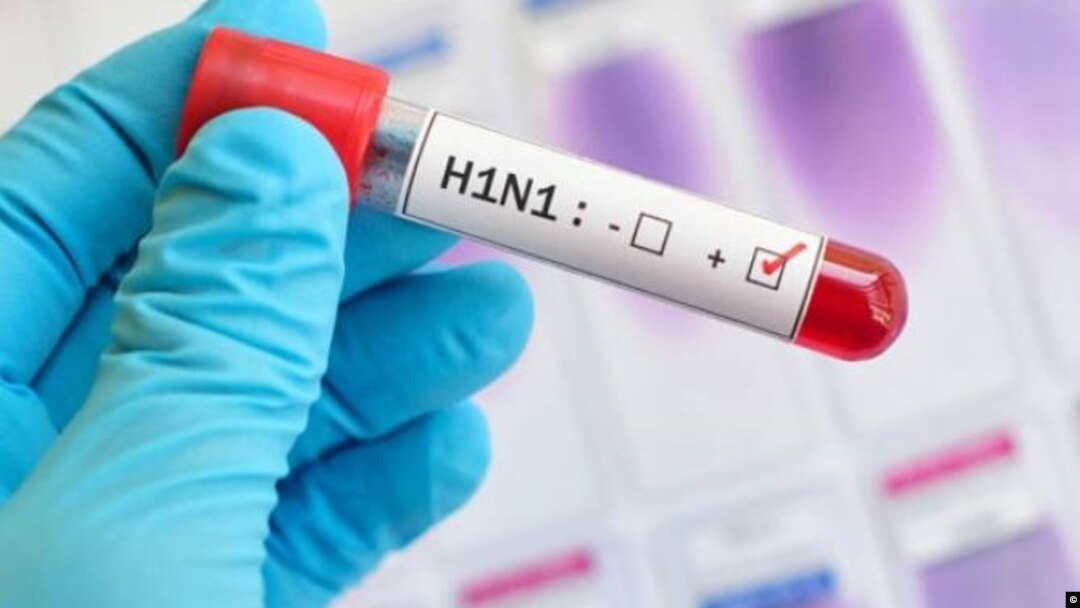 H1N1